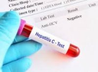 НОВІ СТАНДАРТИ: СПРОЩЕНО АЛГОРИТМ ДІАГНОСТИКИ ВГС