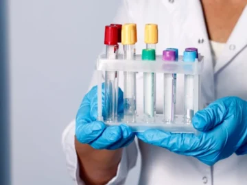 В КНП « Чорнухинська лікарня» проводяться лабораторні обстеження